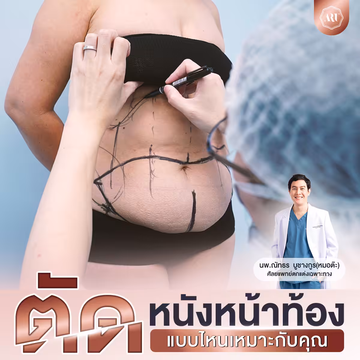 ตัดหนังหน้าท้องแบบไหนเหมาะกับคุณ