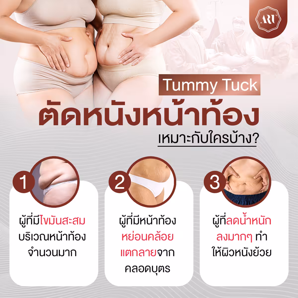 ตัดหนังหน้าท้อง เหมาะกับใคร
