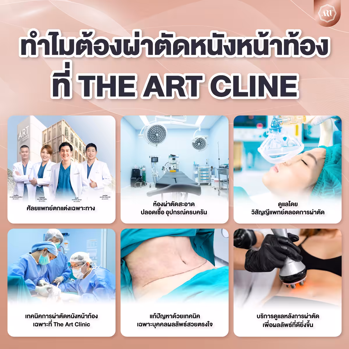 ทำไมต้องตัดหนังหน้าท้องที่ The Art Clinic