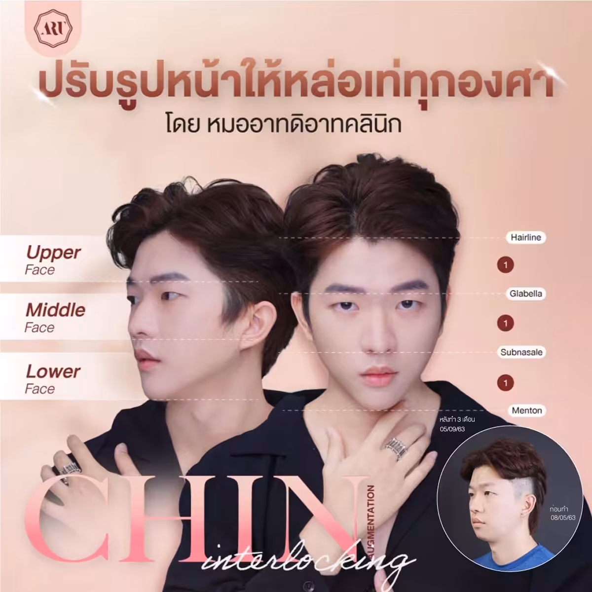 สัดส่วนใบหน้า และคาง