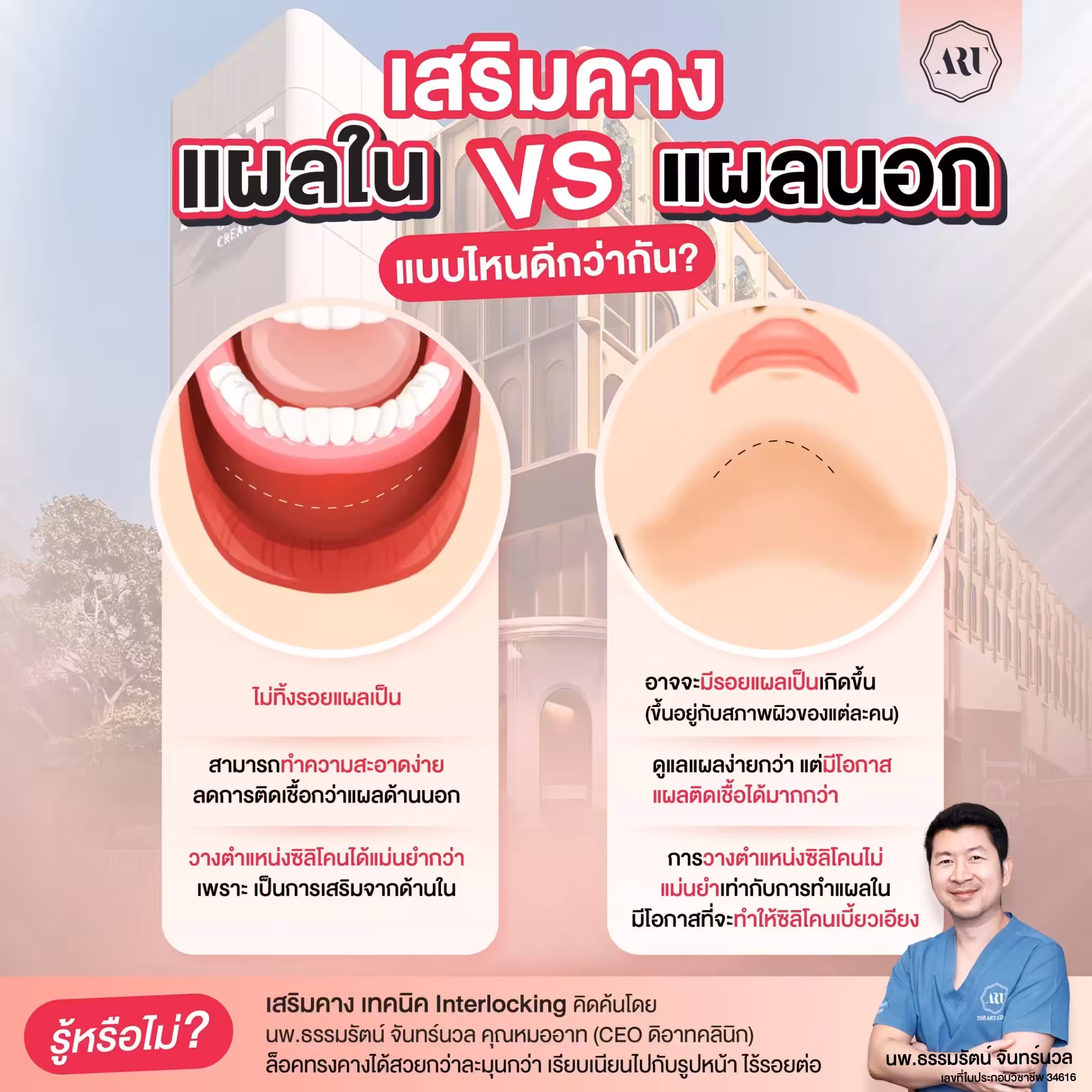 เสริมคางแผลใน กับ เสริมคางแผลนอก