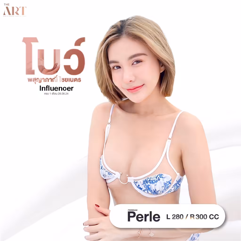 รีวิวคุณโบว์ เสริมหน้าอก ที่ The Art