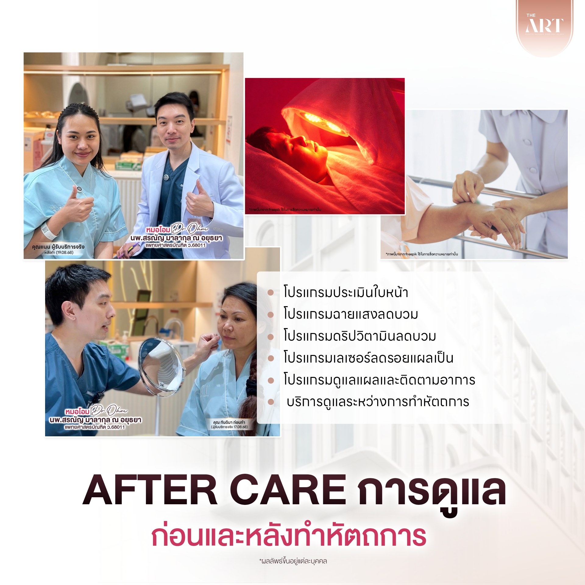เติมไขมัน ดิอาท 02