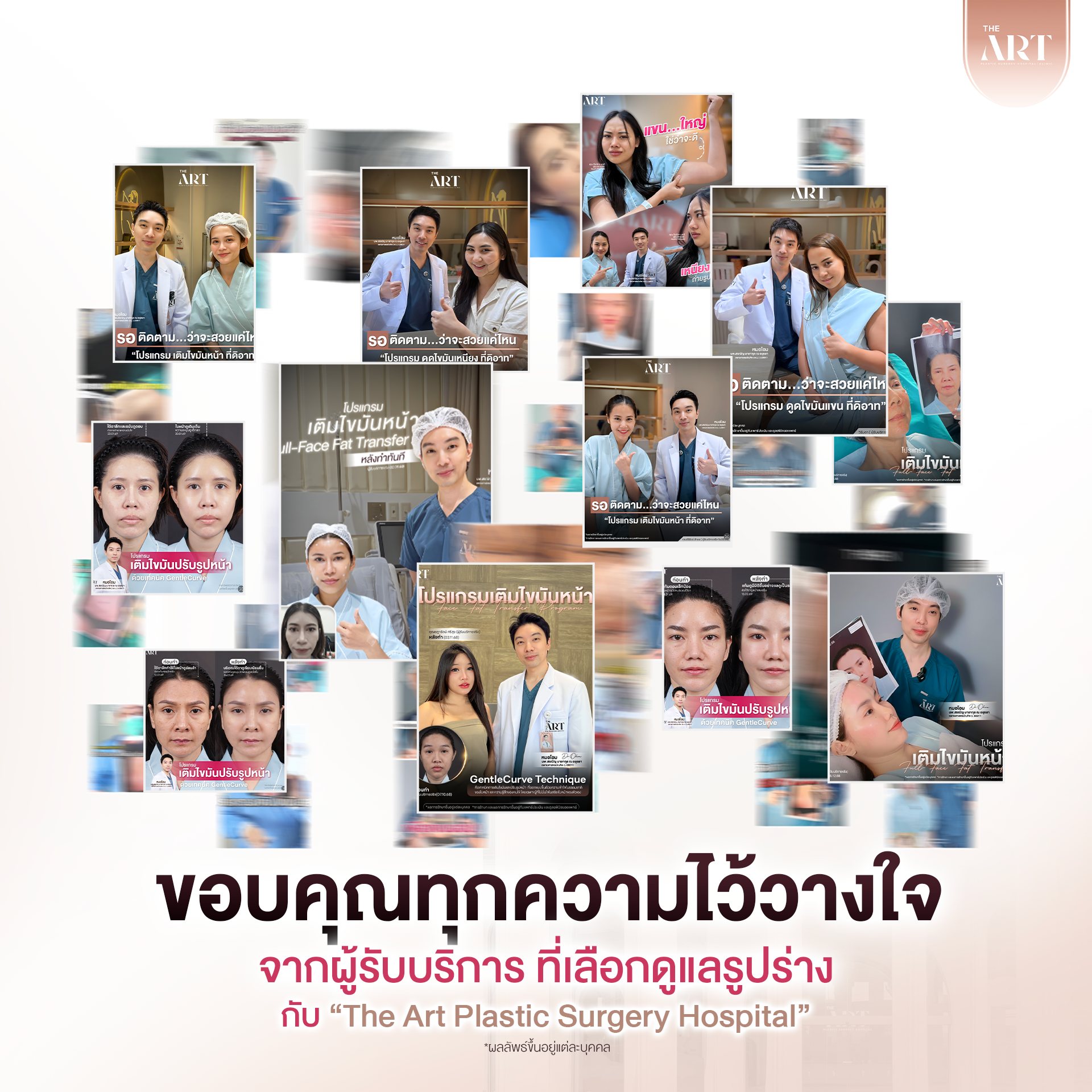 เติมไขมัน ดิอาท03