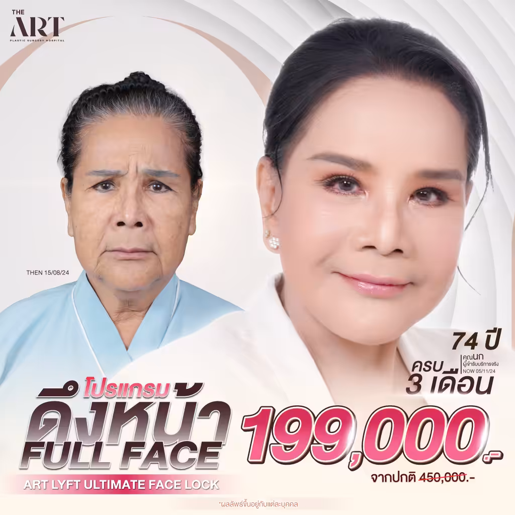 Promotion ดึงหน้า Fullface 199,000 บาท