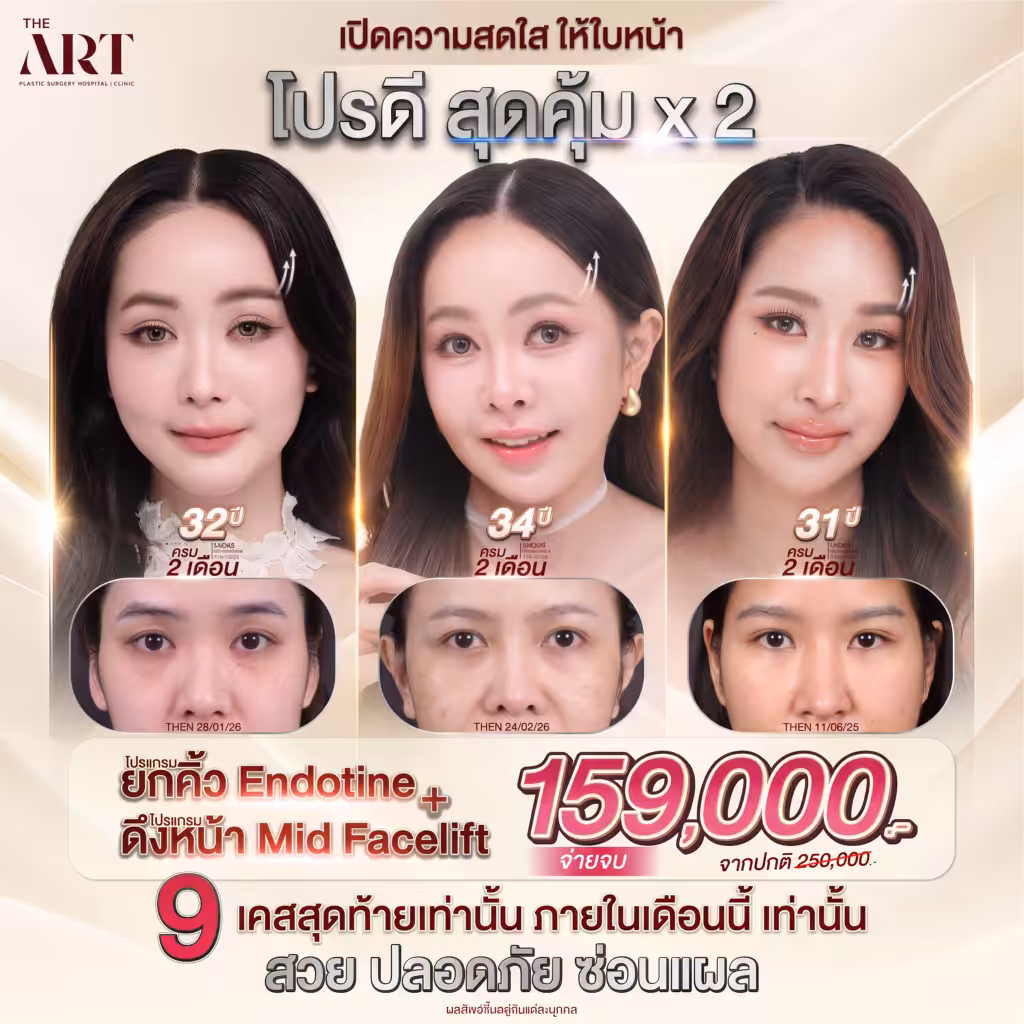 Promotion Facelift Theart