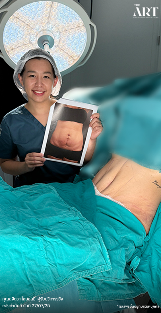 DM6800802 สุจิตรา โลมสนธิ์ หลังทำ 27.07.25