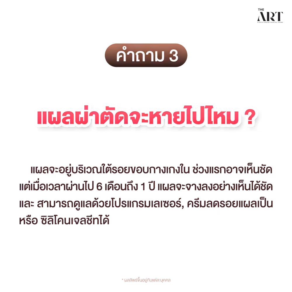 IG_T479 5 คำถามยอดฮิต_04