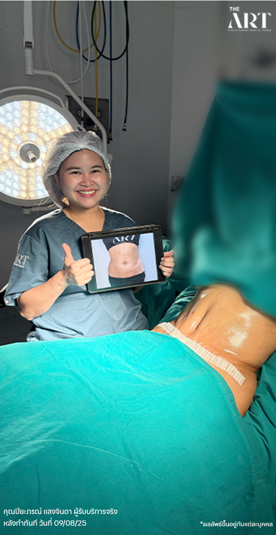 LP6705050 ปิยะภรณ์ แสงจินดา หลังทำ 09.08.25