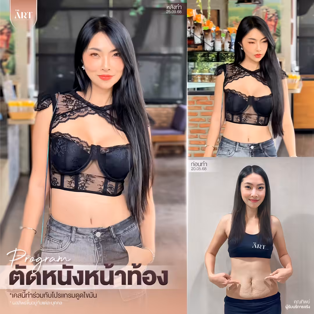T580 อันดับ1วงใน_02_0