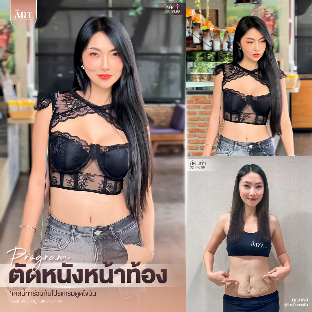 T580 อันดับ1วงใน_02_0