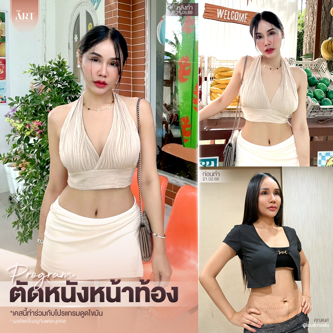 T580 อันดับ1วงใน_03_0