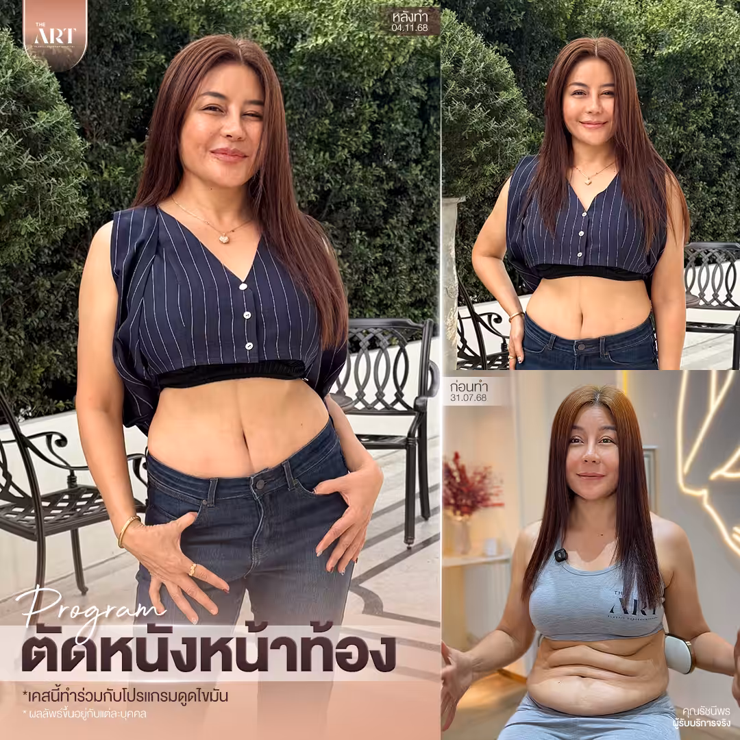 T580 อันดับ1วงใน_04_0
