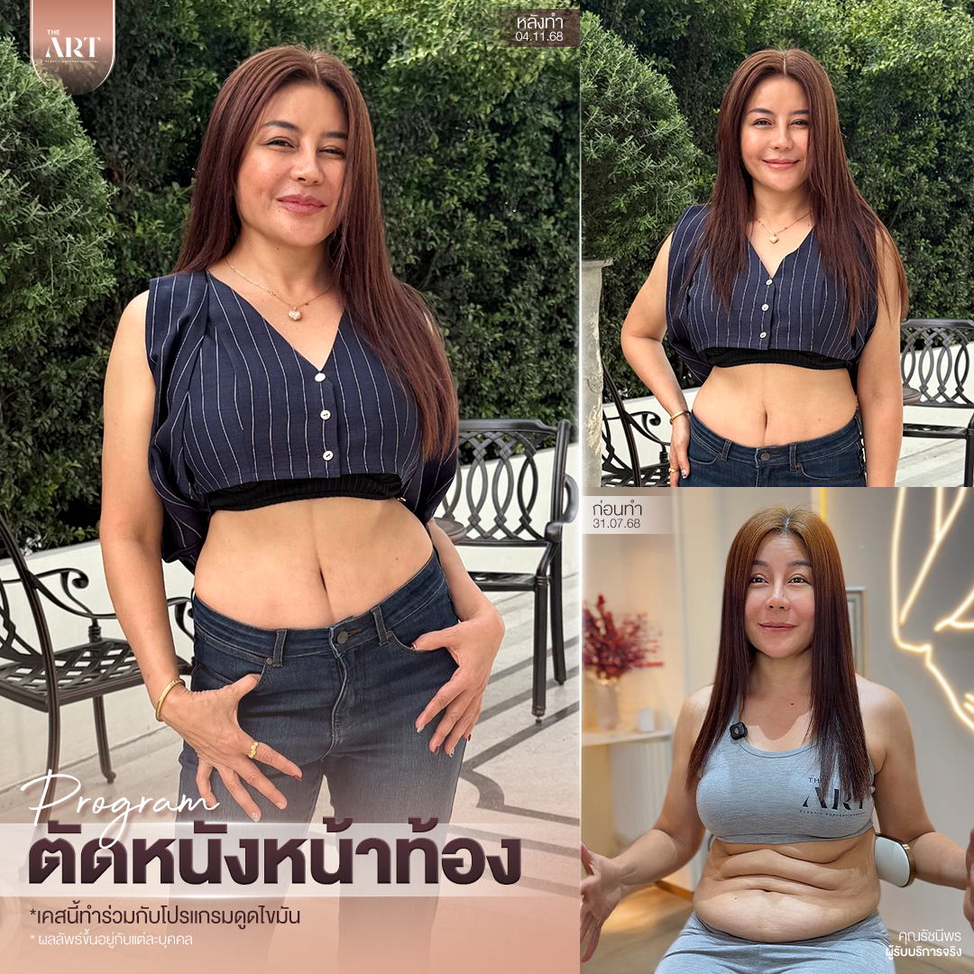 T580 อันดับ1วงใน_04_0