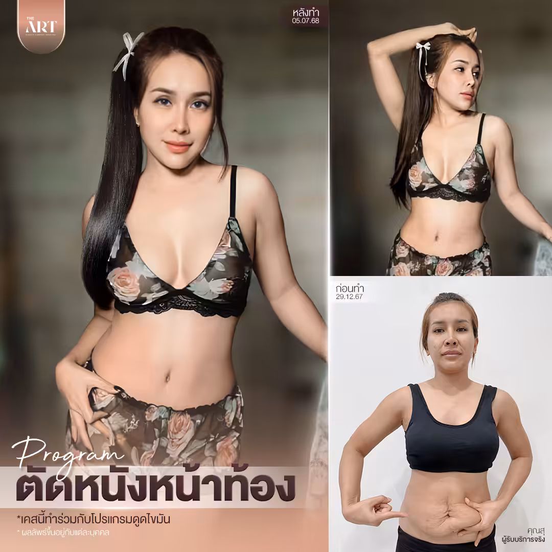 T580 อันดับ1วงใน_05_0