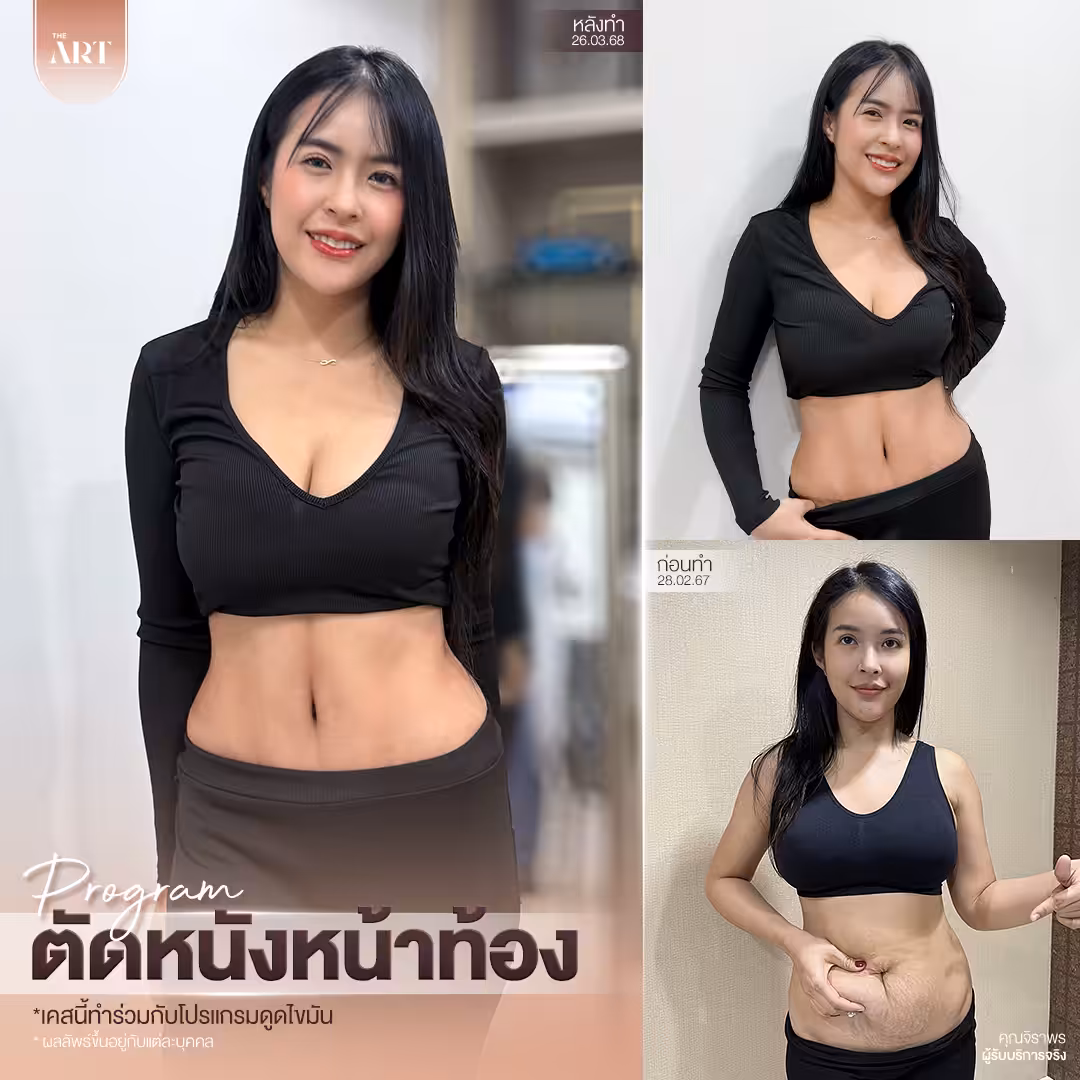 T580 อันดับ1วงใน_06_0