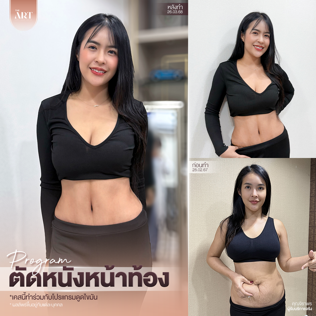 T580 อันดับ1วงใน_06_0