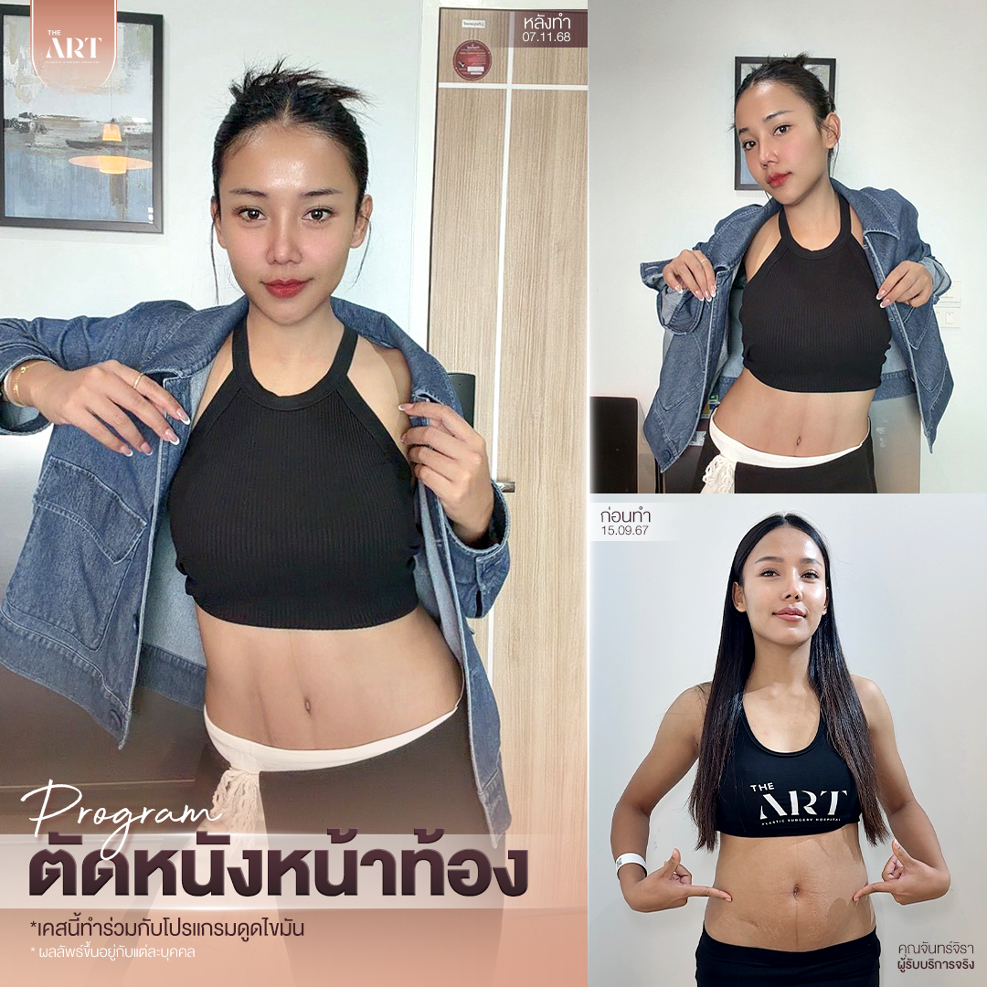 T580 อันดับ1วงใน_07_0