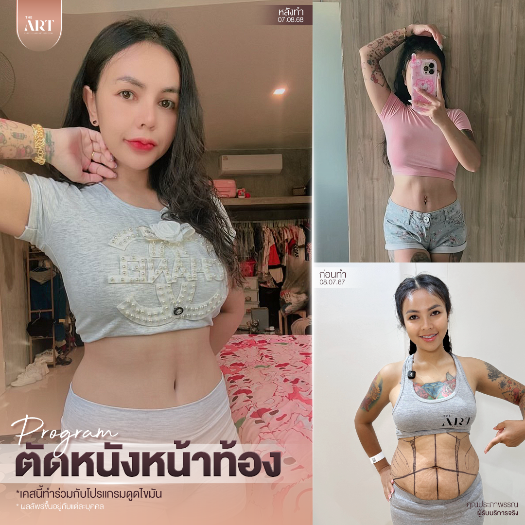 T580 อันดับ1วงใน_08_0