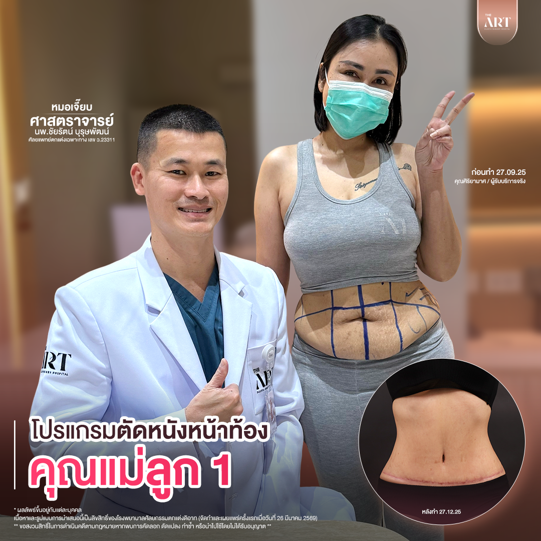 T617 GPหมอเจี๊ยบก่อนทำ_02_0_0