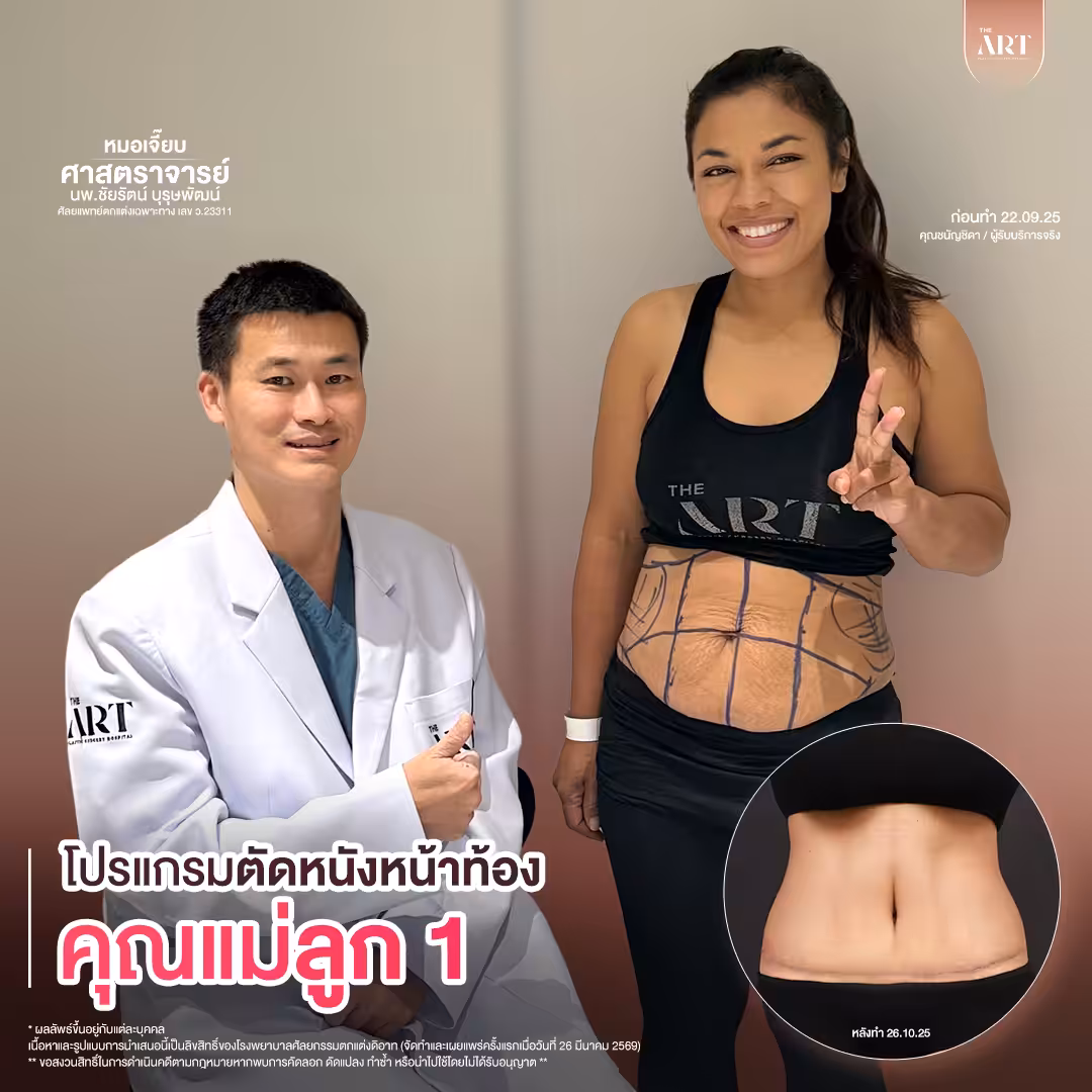 T617 GPหมอเจี๊ยบก่อนทำ_03_0_0