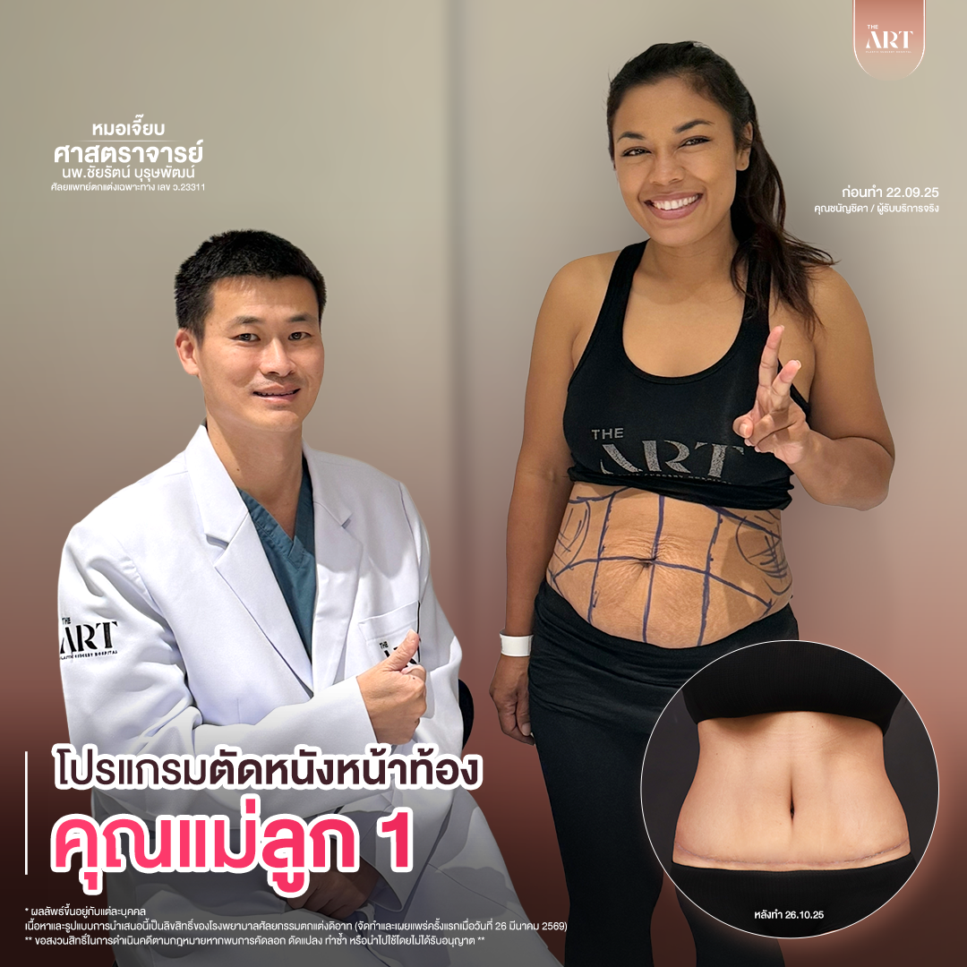 T617 GPหมอเจี๊ยบก่อนทำ_03_0_0