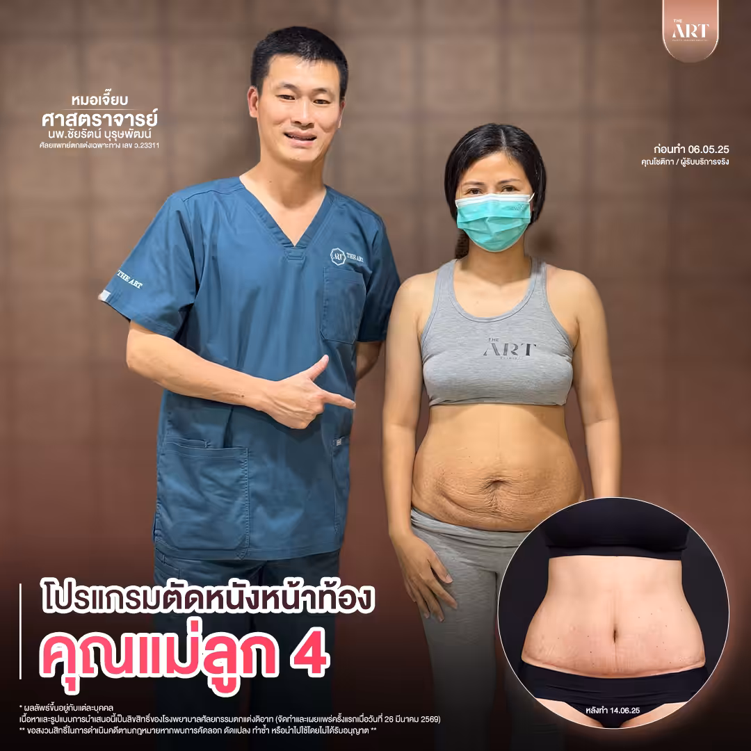 T617 GPหมอเจี๊ยบก่อนทำ_04_0_0