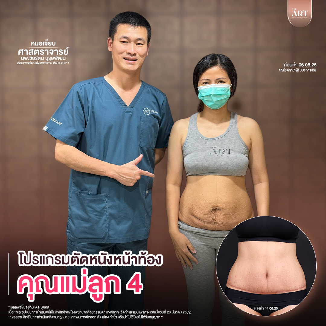 T617 GPหมอเจี๊ยบก่อนทำ_04_0_0