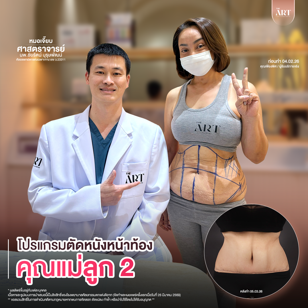 T617 GPหมอเจี๊ยบก่อนทำ_05_0_0