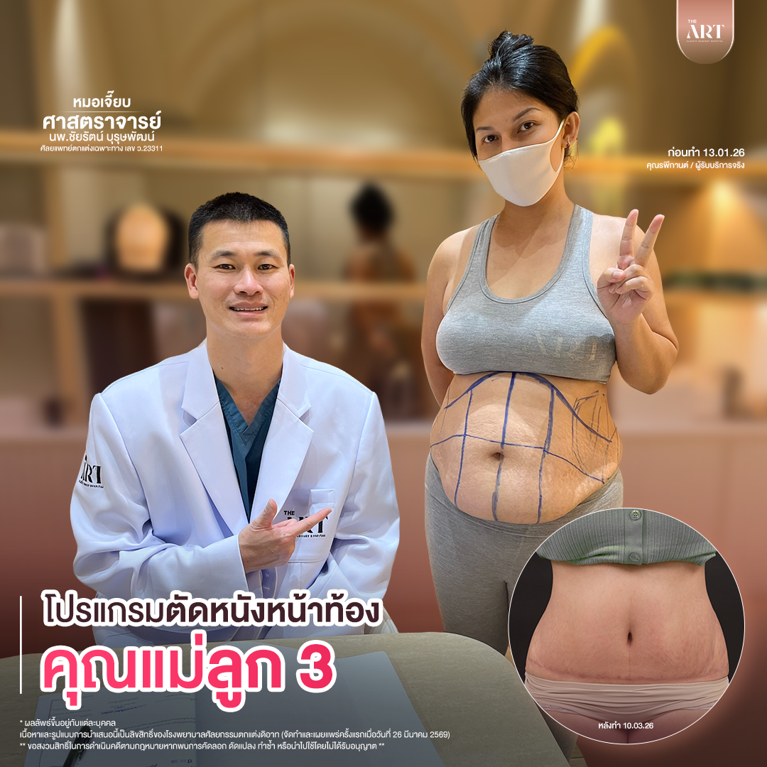 T617 GPหมอเจี๊ยบก่อนทำ_06_0_0