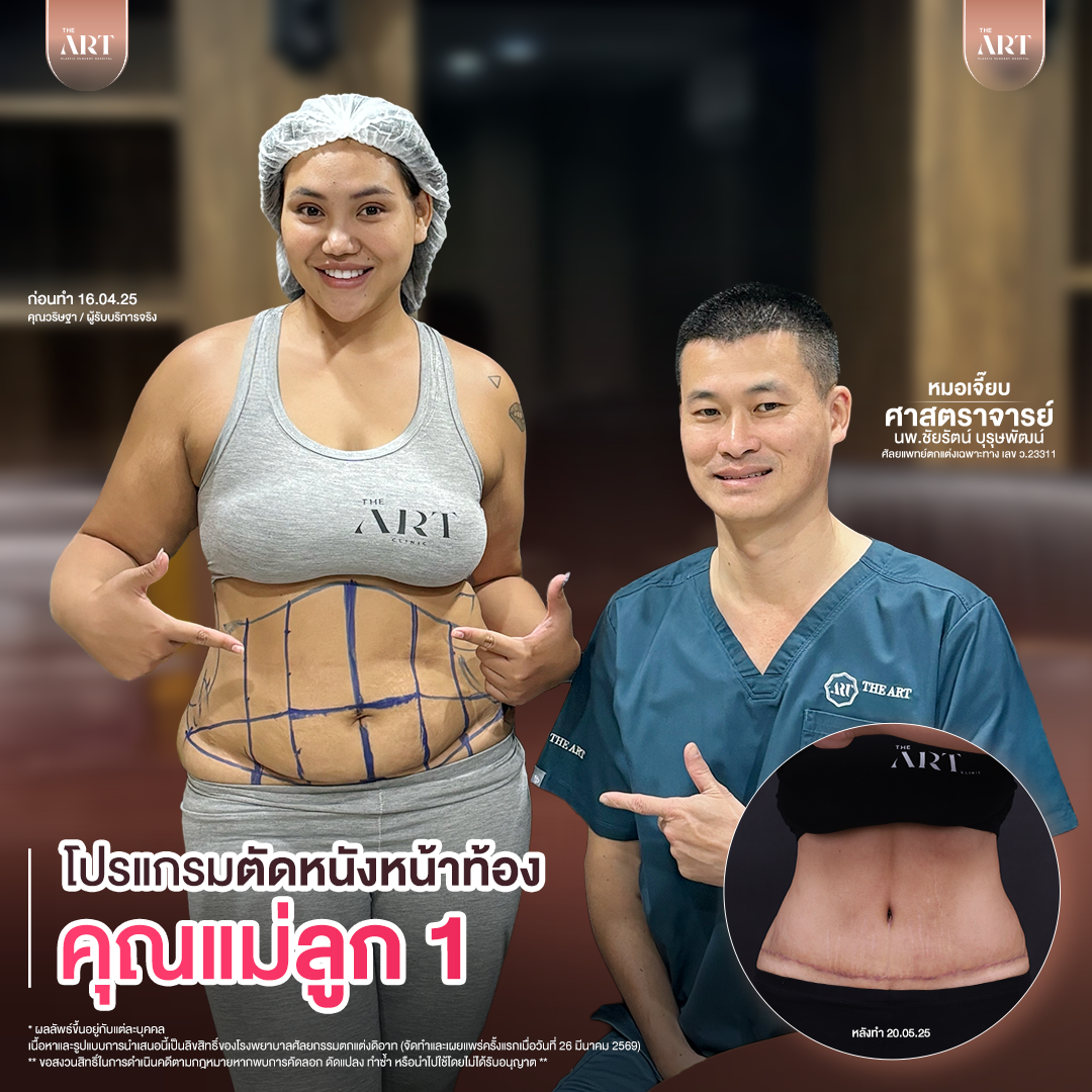 T617 GPหมอเจี๊ยบก่อนทำ_09_0_0