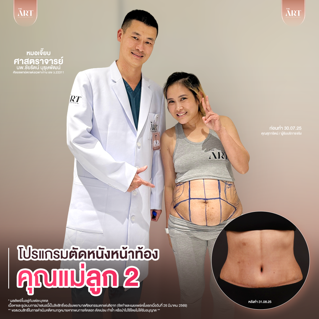 T617 GPหมอเจี๊ยบก่อนทำ_10_0_0