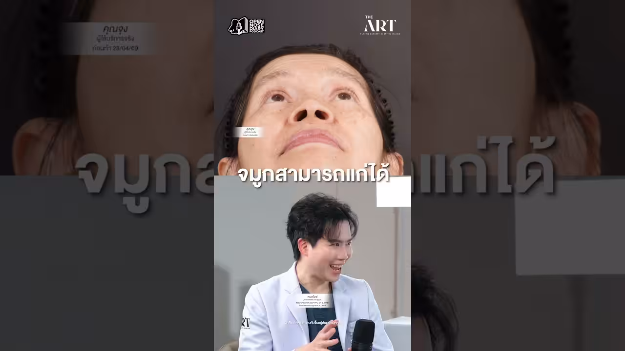Yt จมูก Open