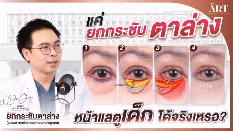 Facelift Dr jay_yt_แค่ยกกระชับตาล่าง...ก็แลดูเด็กได้ จริงหรอ