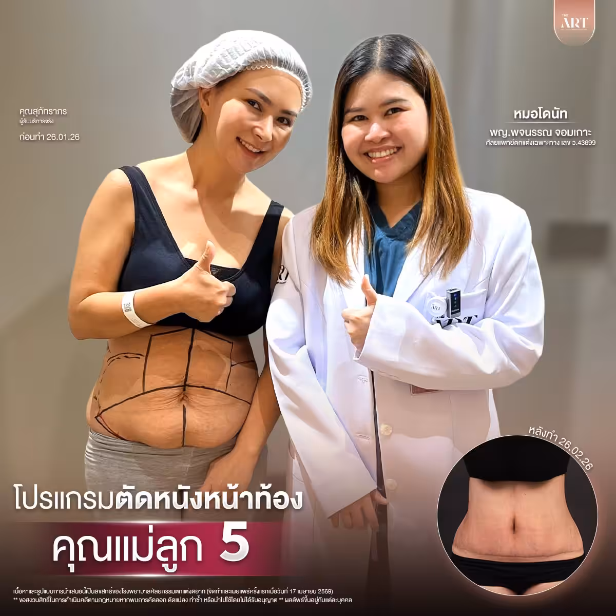 ตัดหนัง หมอโดนัท02