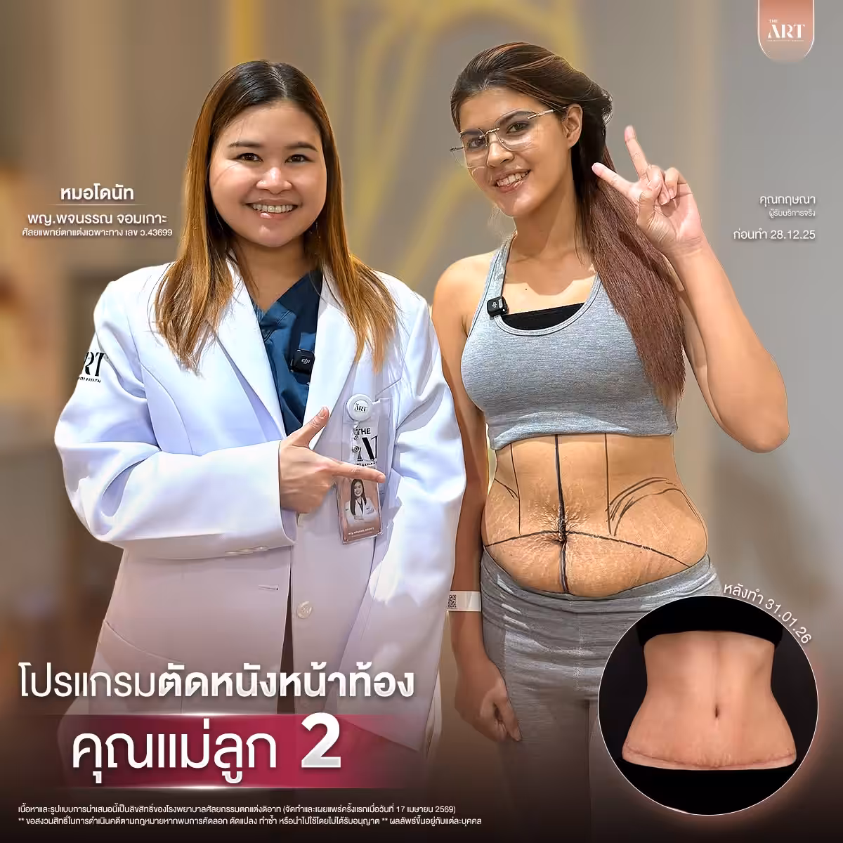 ตัดหนัง หมอโดนัท03