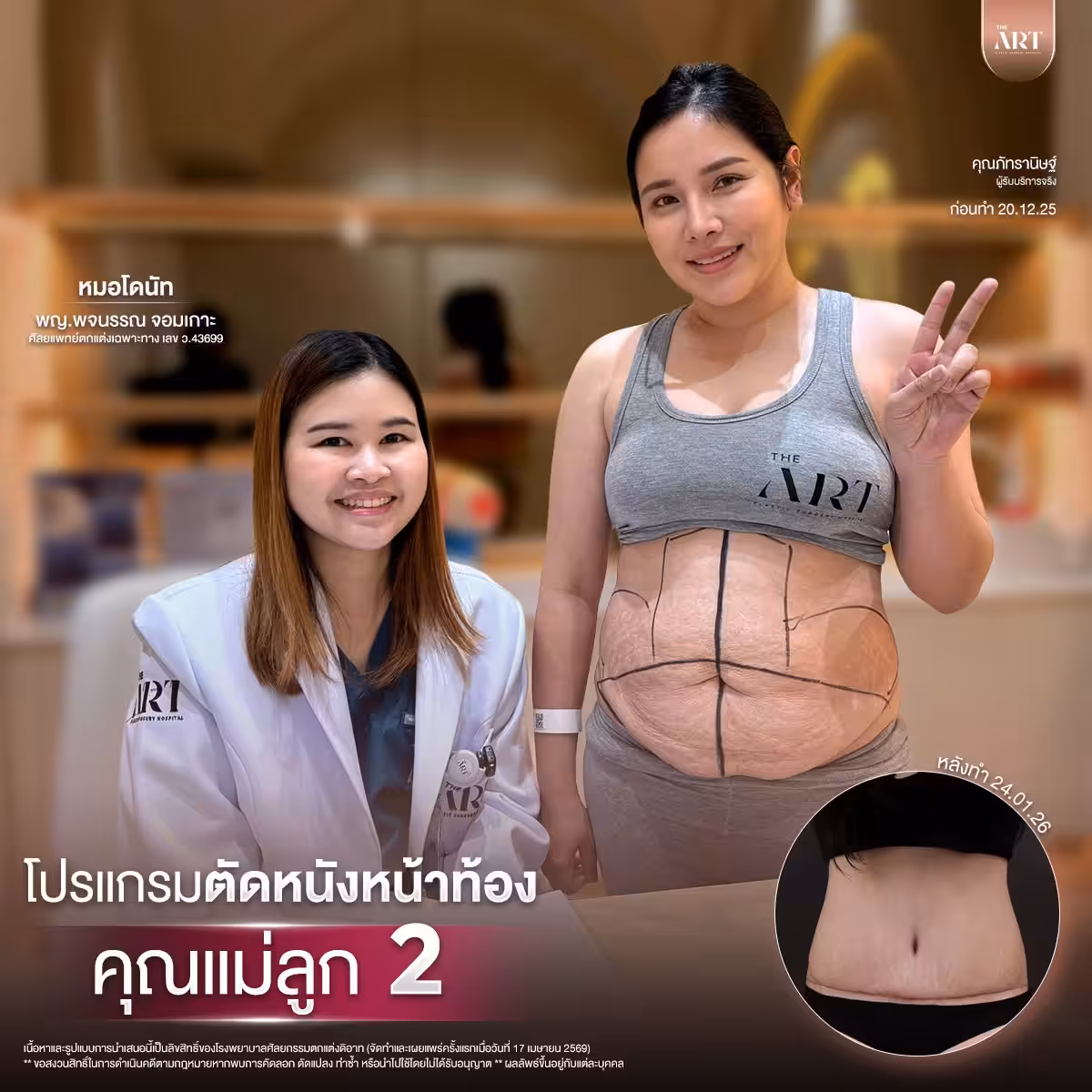 ตัดหนัง หมอโดนัท04