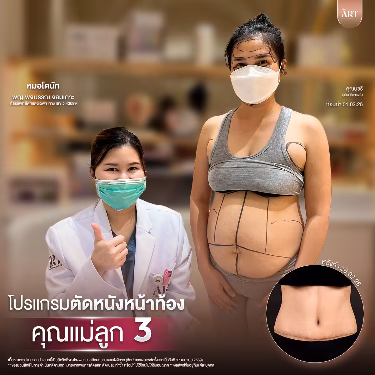 ตัดหนัง หมอโดนัท05