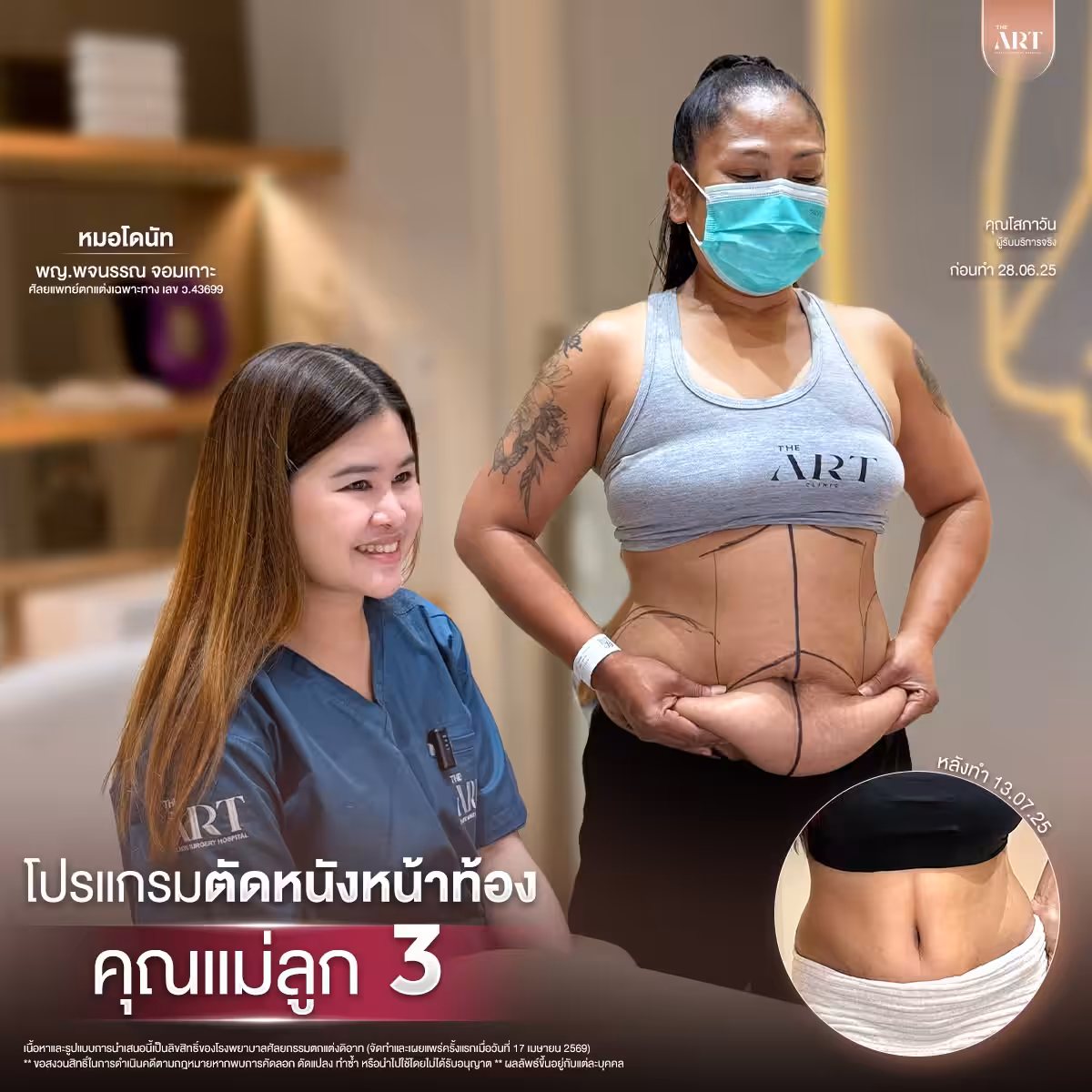 ตัดหนัง หมอโดนัท06