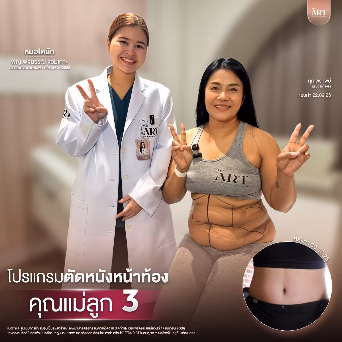 ตัดหนัง หมอโดนัท08