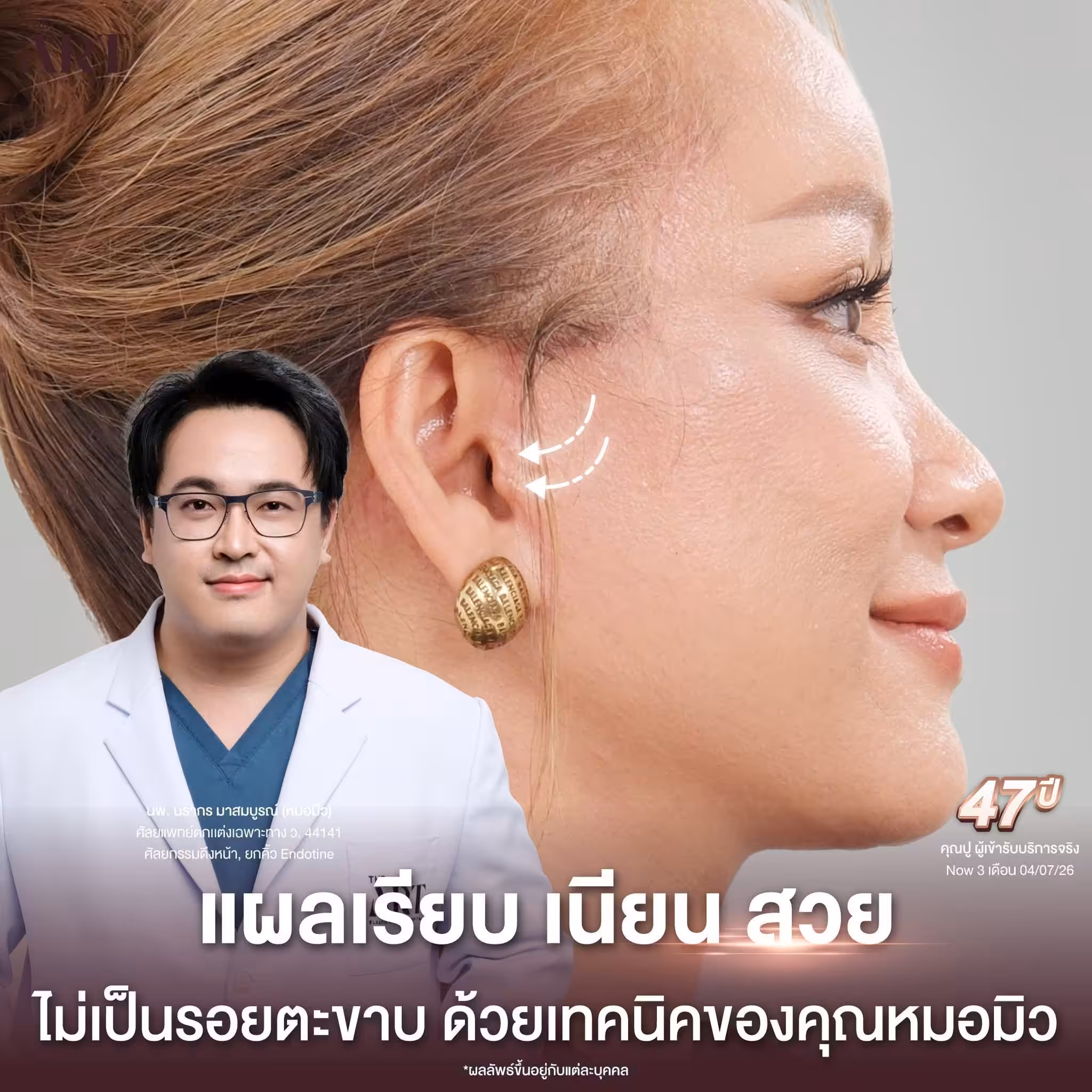 หมอมิว 5