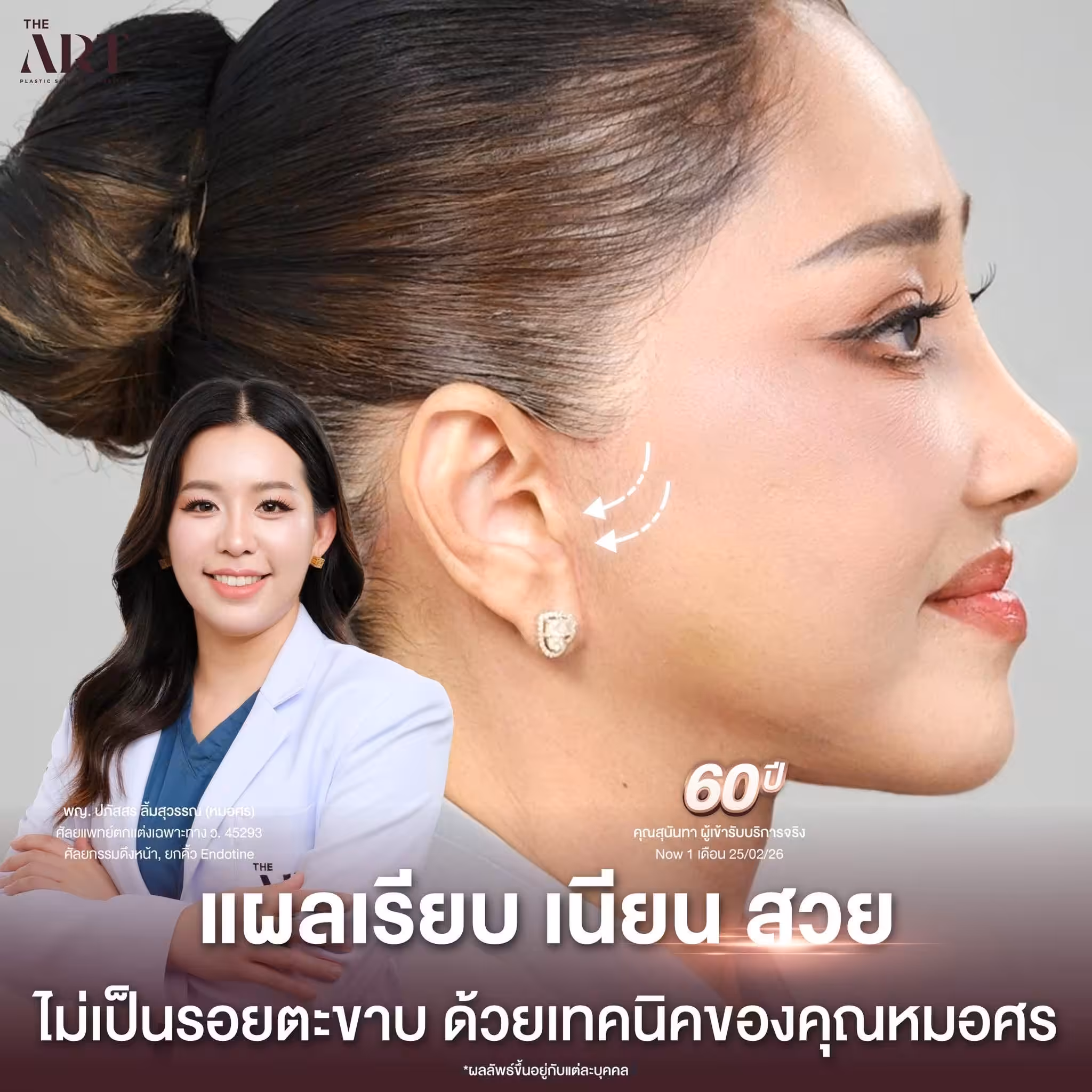 หมอศร 3
