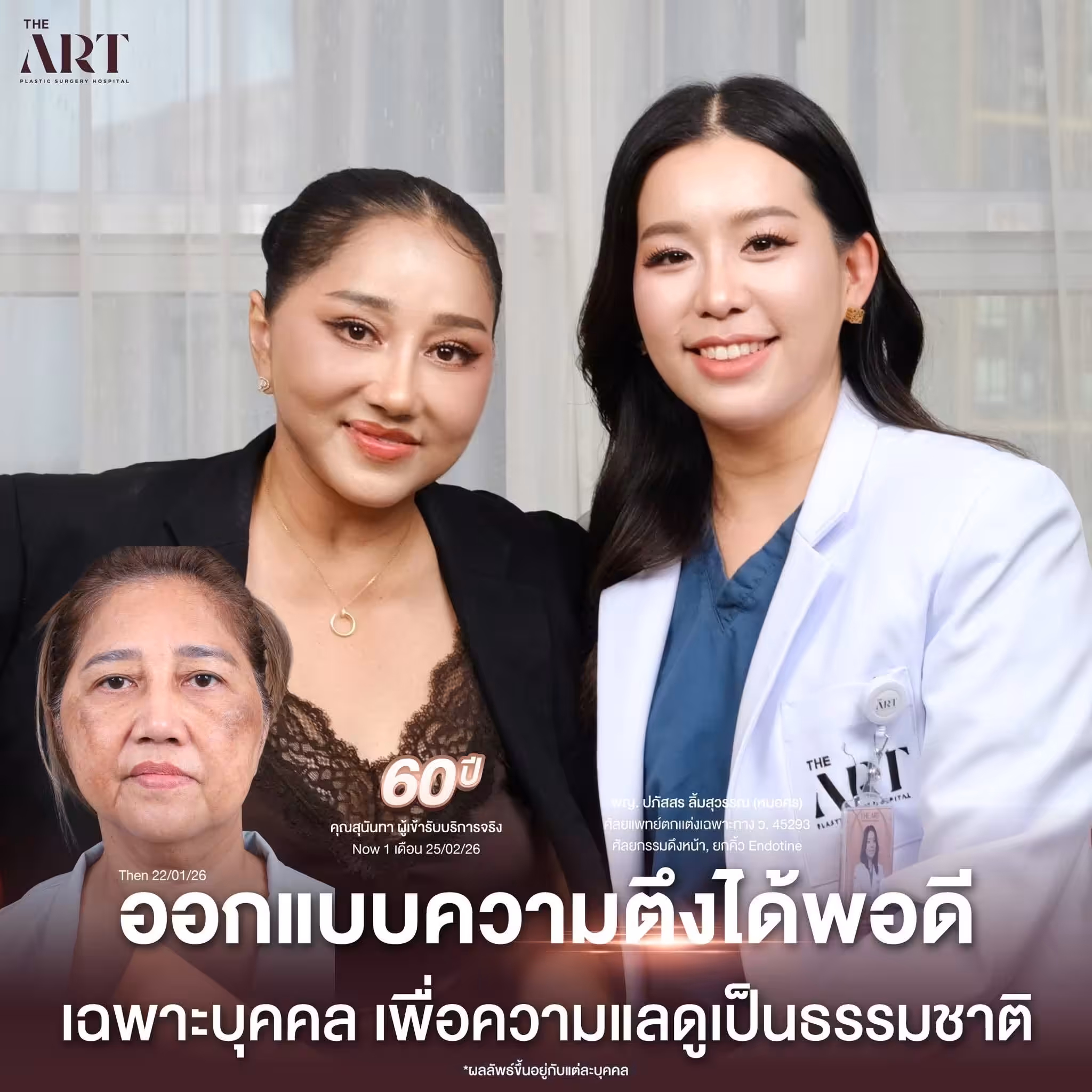 หมอศร 4