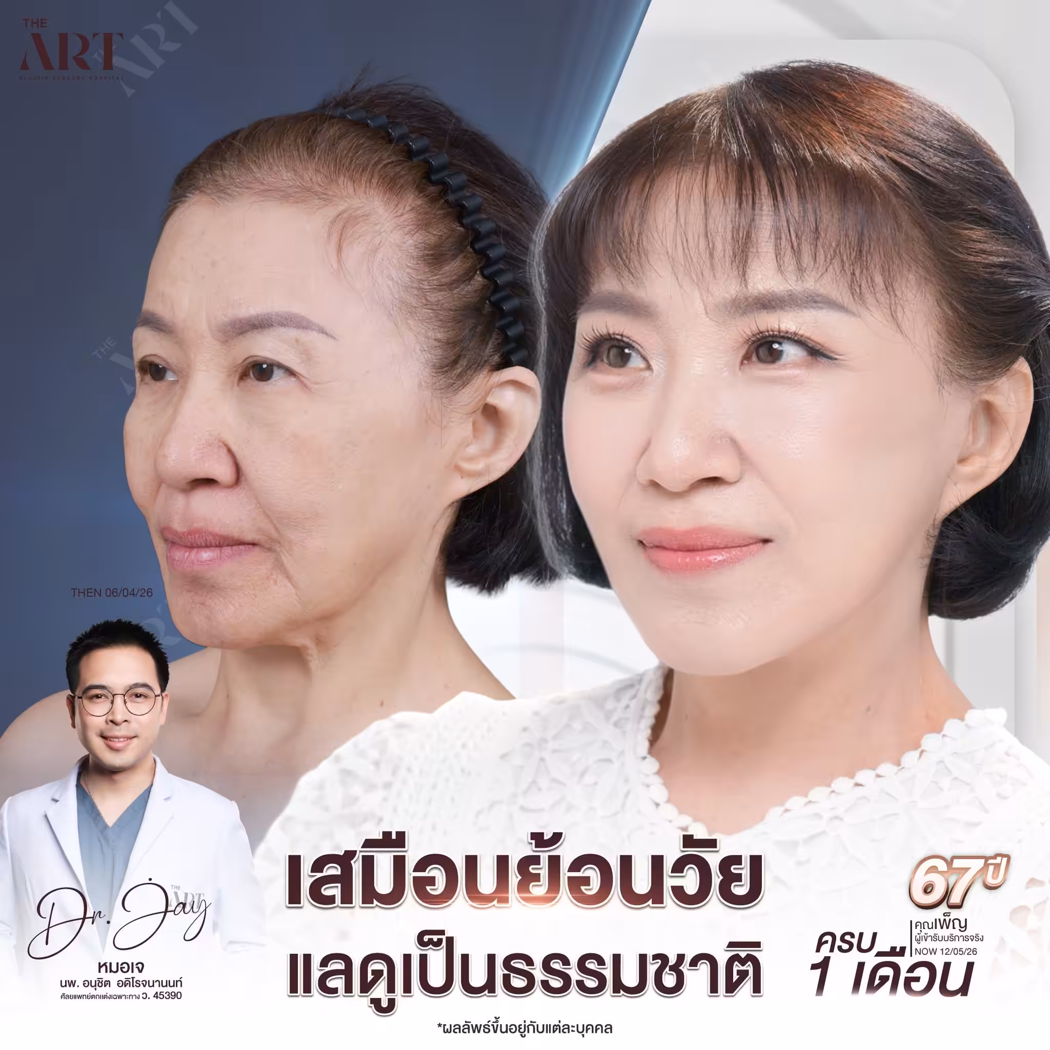 หมอเจ 04