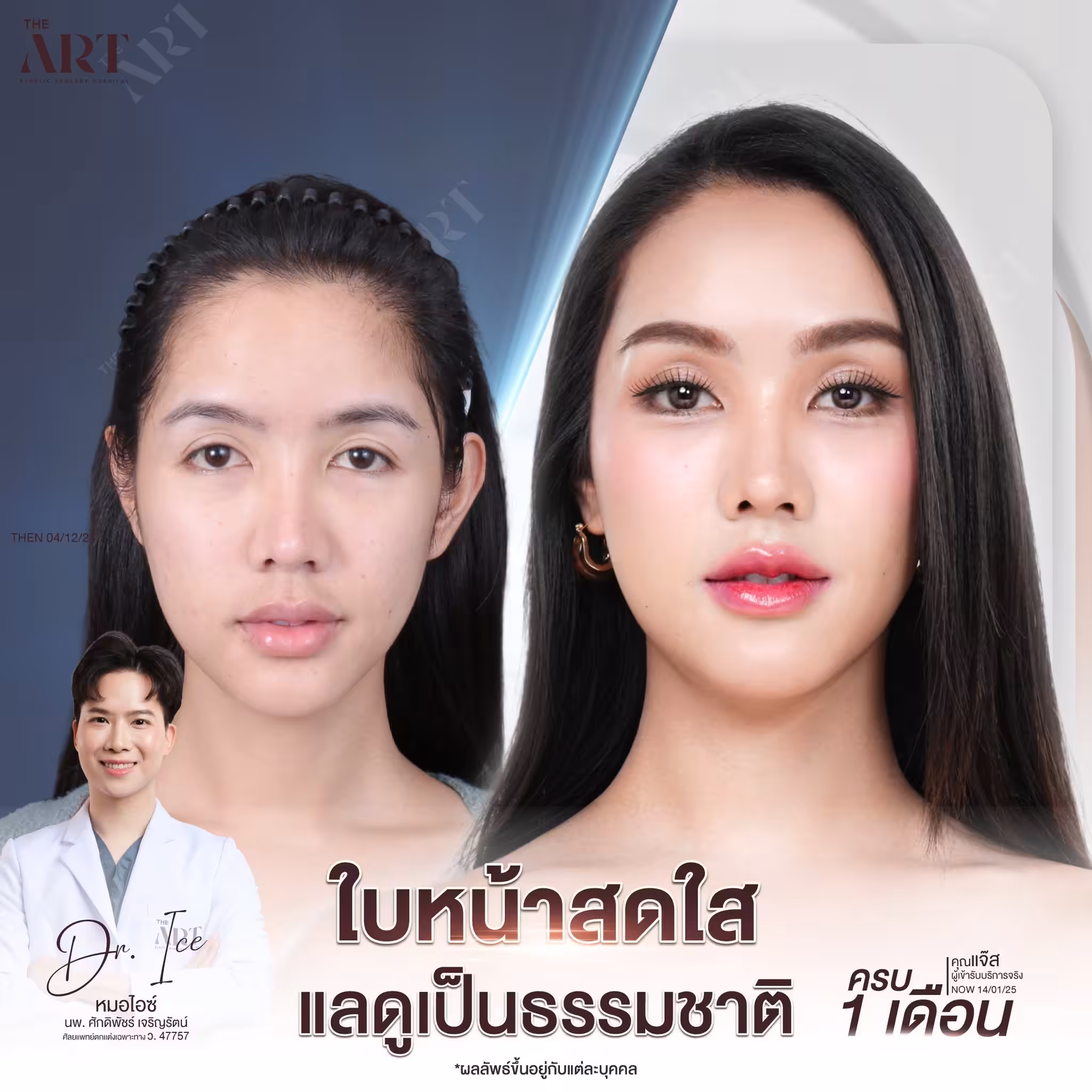 หมอไอซ์ ดิอาท 02