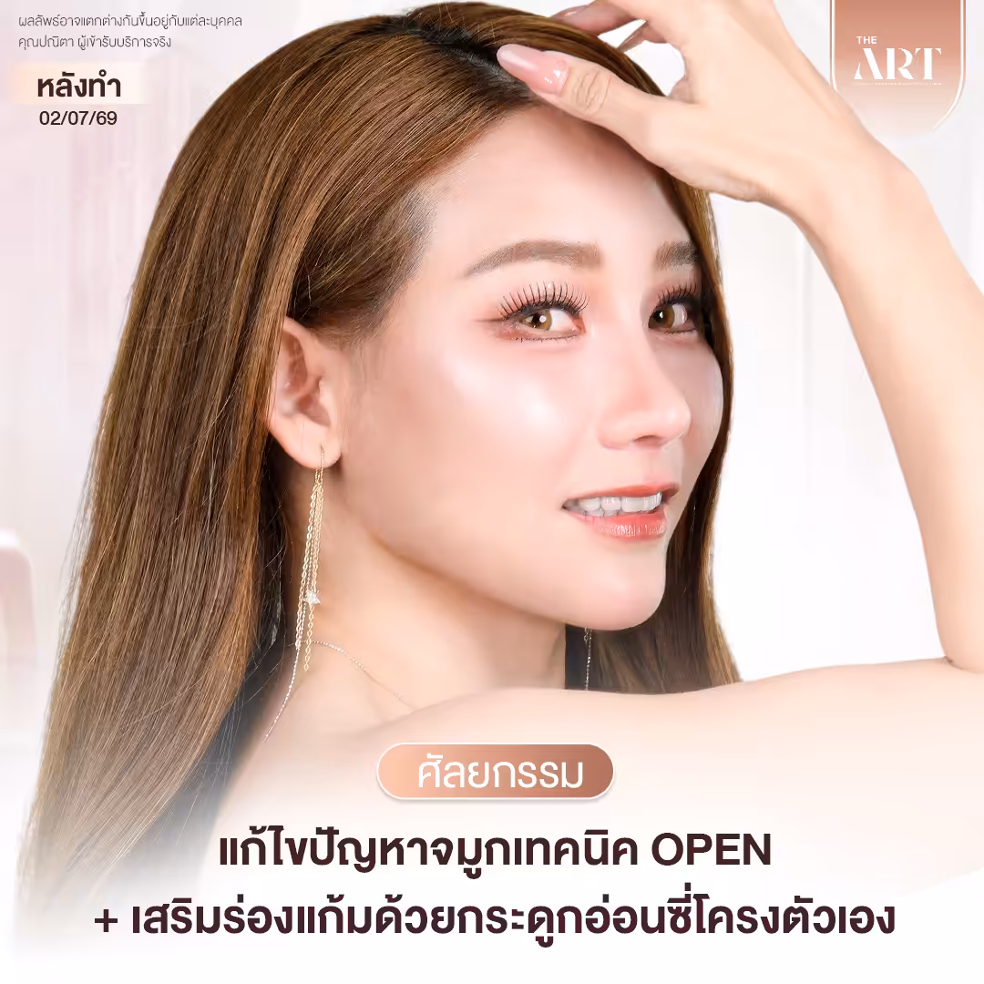 แม่นุ้ย Surgery Wars