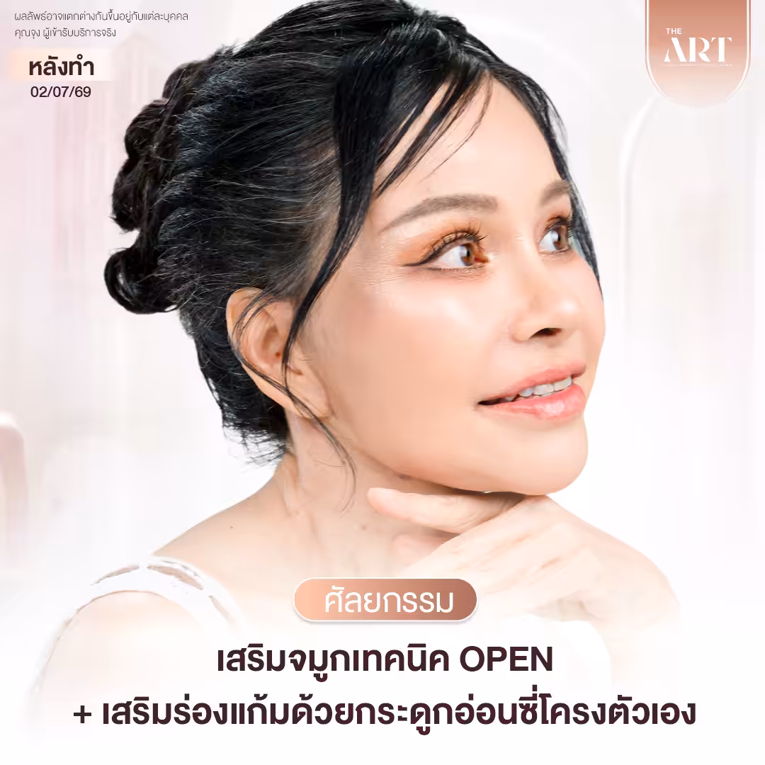 แม่จุง  Surgery Wars
