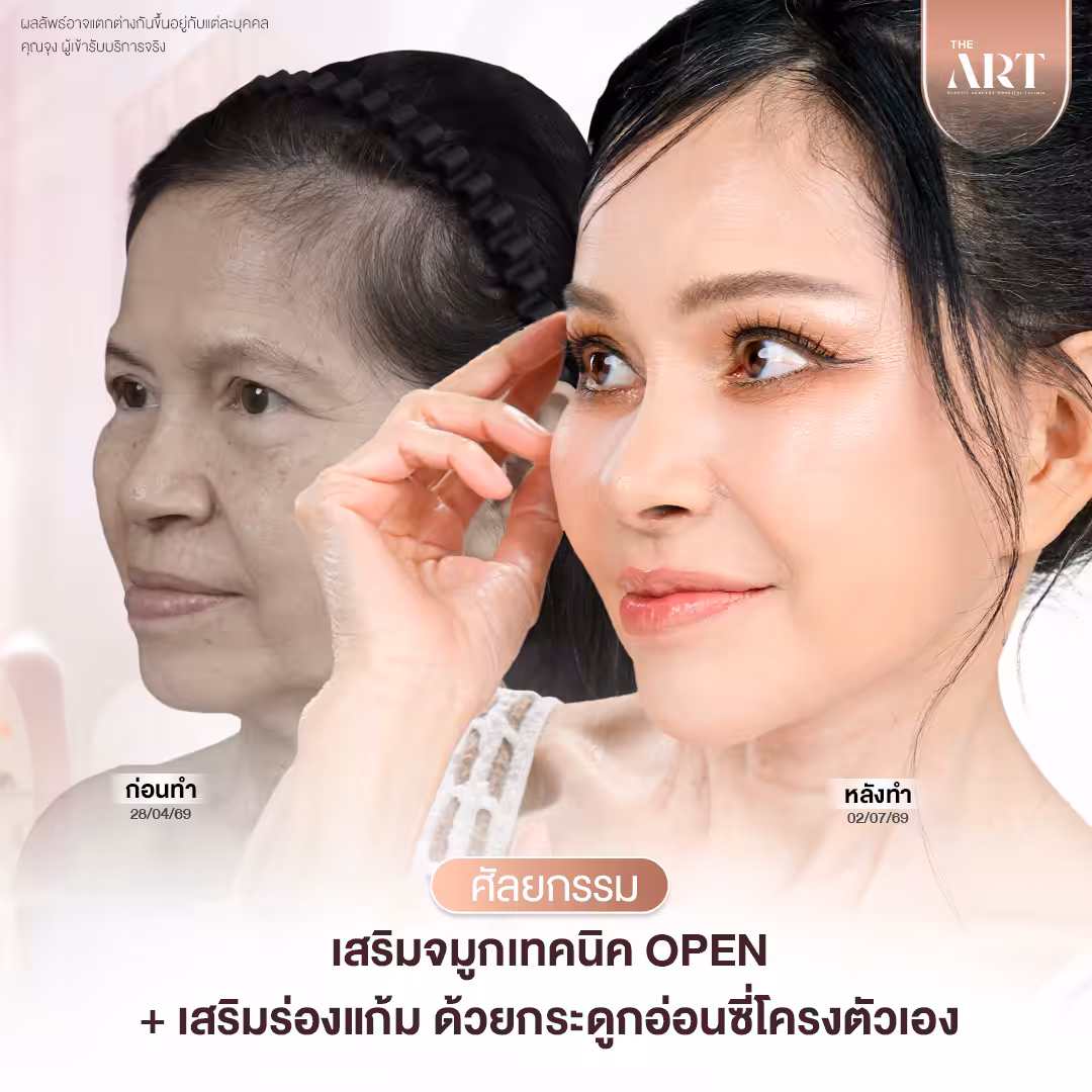 แม่จุง  Surgery Wars