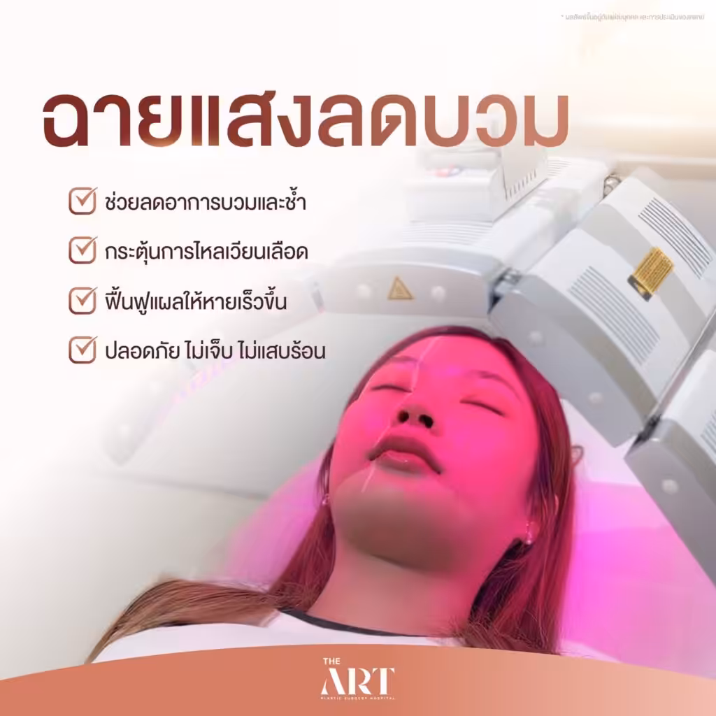 ฉายแสงลดบวม