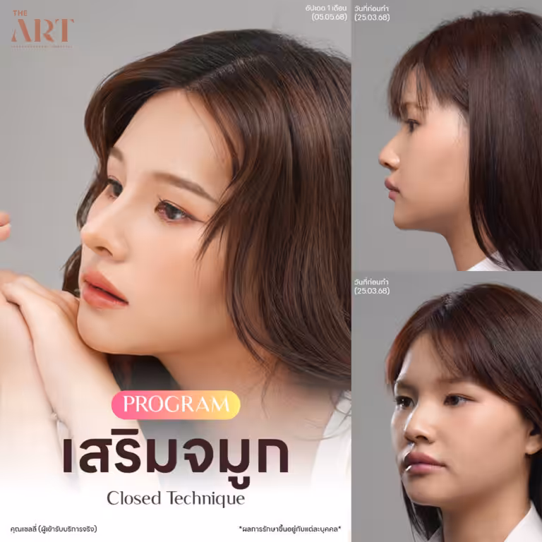 จมูก Triple Lock4